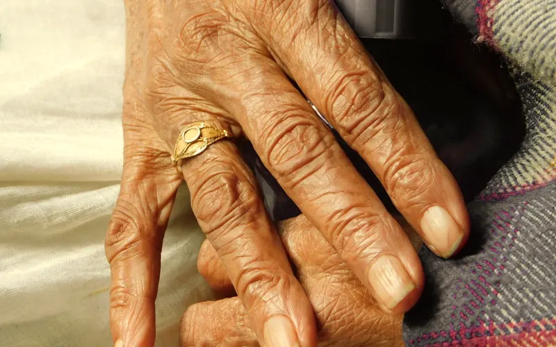 Mãos e articulações dos dedos em primeiro plano